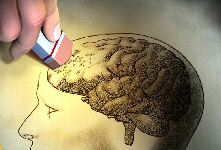 What We Learned About Alzheimer’s Disease in 2023