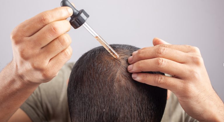 FDA Faz Alerta Contra Medicamento Popular Para Queda De Cabelo