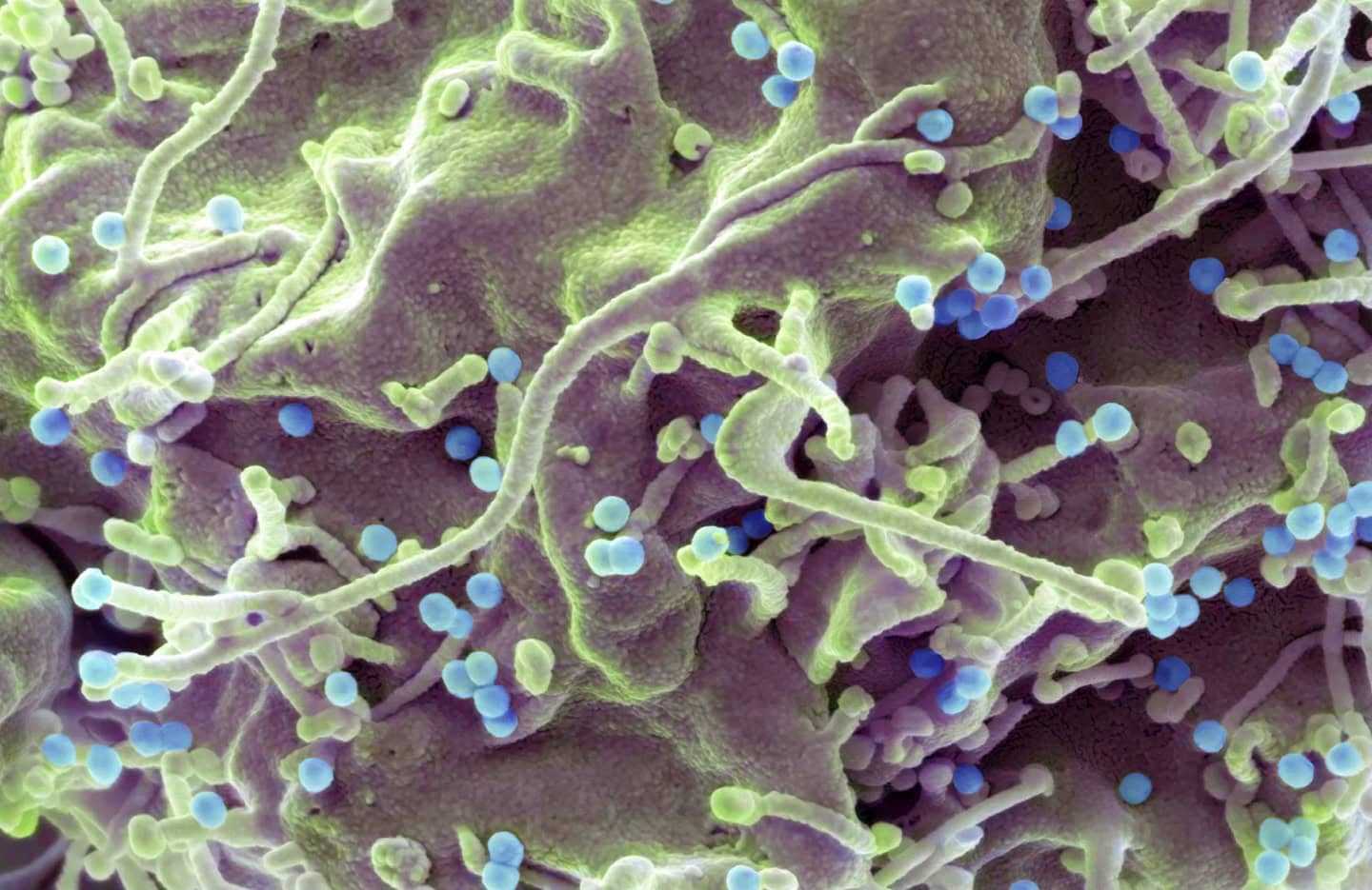 A New One-A-Day-Pill Holds Promise For HIV’s ‘Forgotten Population’