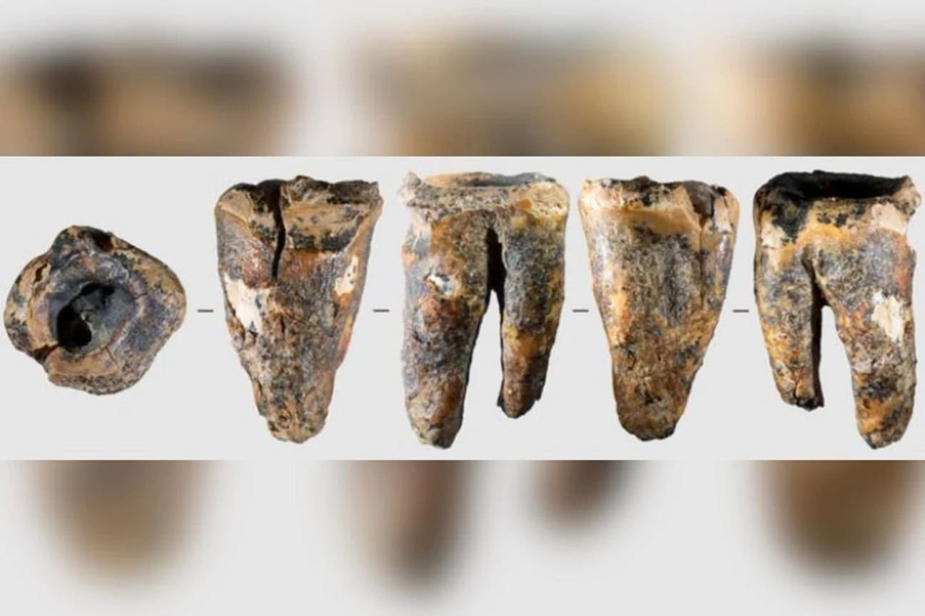 Neanderthals May Have Drilled Out A Cavity 59,000 Years Ago