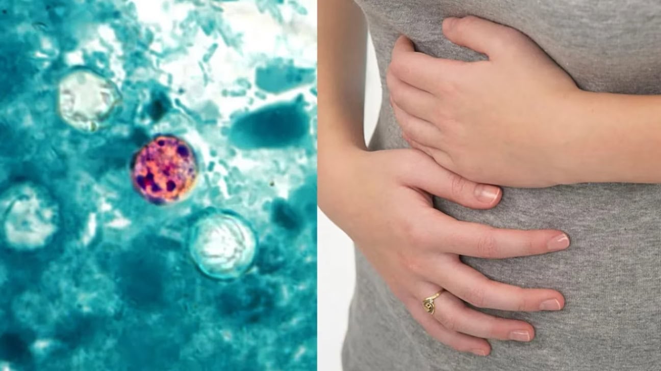What To Know About The Cyclosporiasis Outbreak Hitting More Than Half Of U.S. States